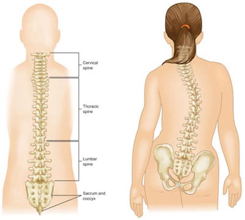 Dr Dina Kulik and Scoliosis, spinal curvature