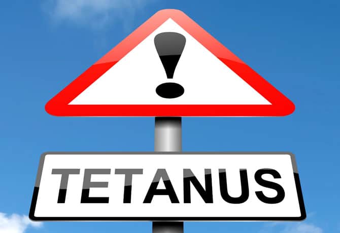 Tetanus Is Out There! What Are The Signs Of Tetanus?