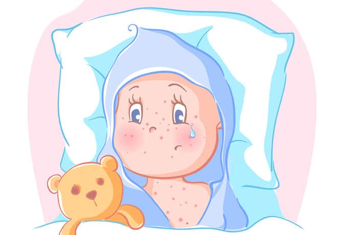 Dr Dina Kulik - Kids Health Blog - baby acne