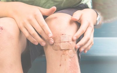Lacerations, Cuts and scrapes – welcome to summer!