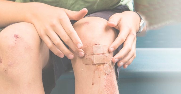 Lacerations, Cuts and scrapes – welcome to summer!